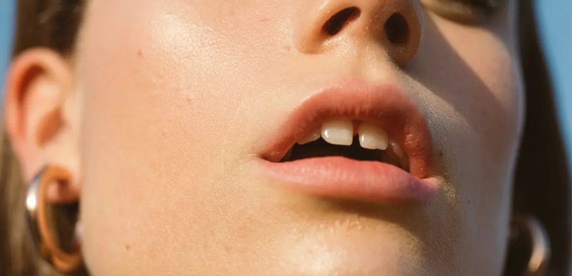 Chapped-lips.jpg